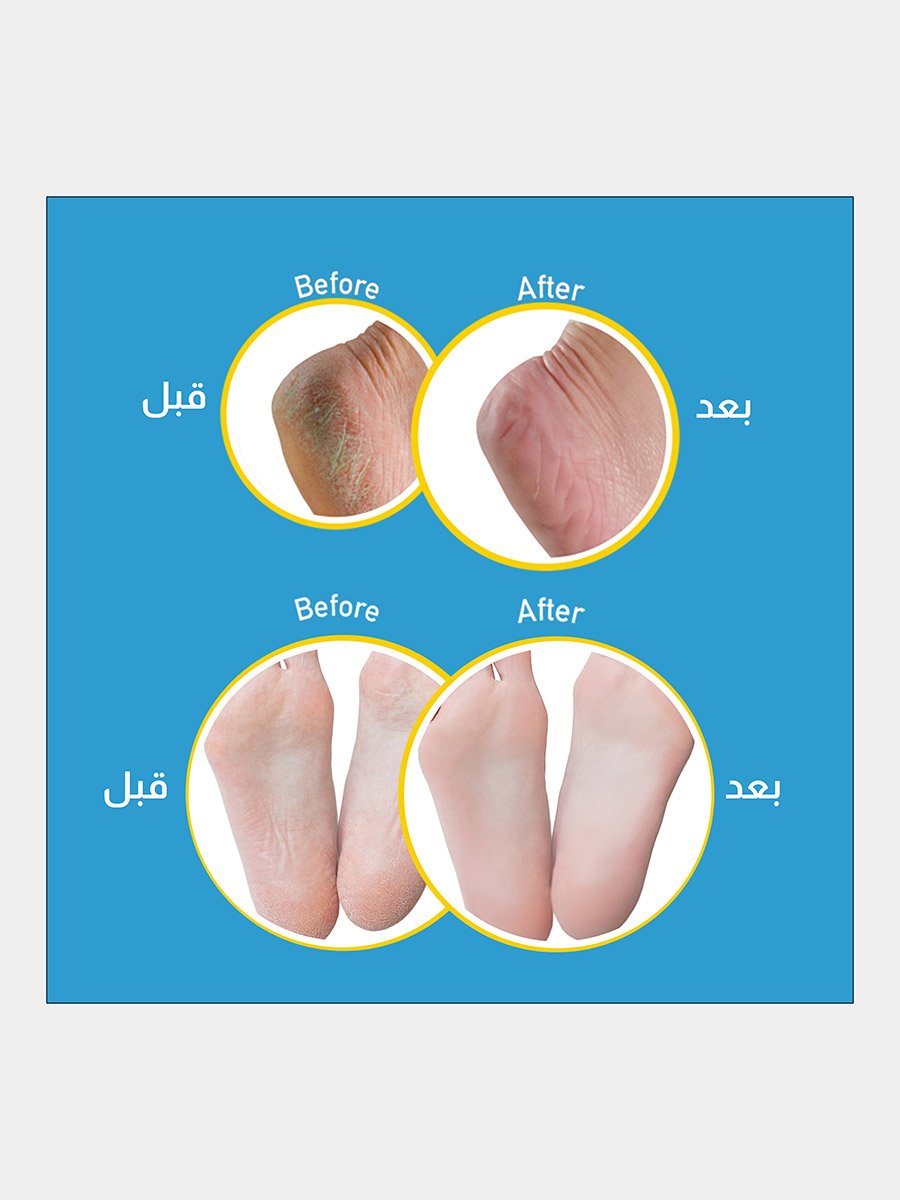 Healthy Feet Cream 2in1 Exfoliates and Moisturizes, 35g