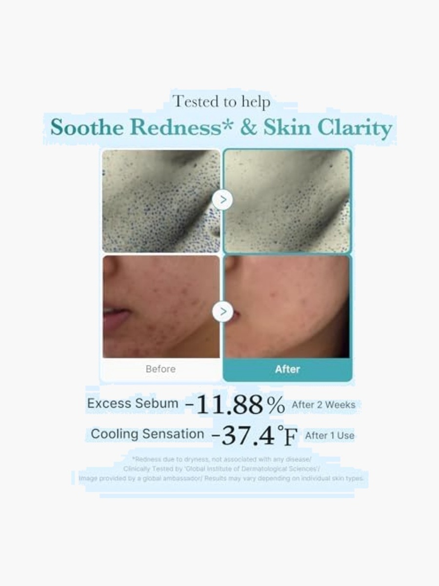 Azelaic Niacinamide Clear Facial Toner