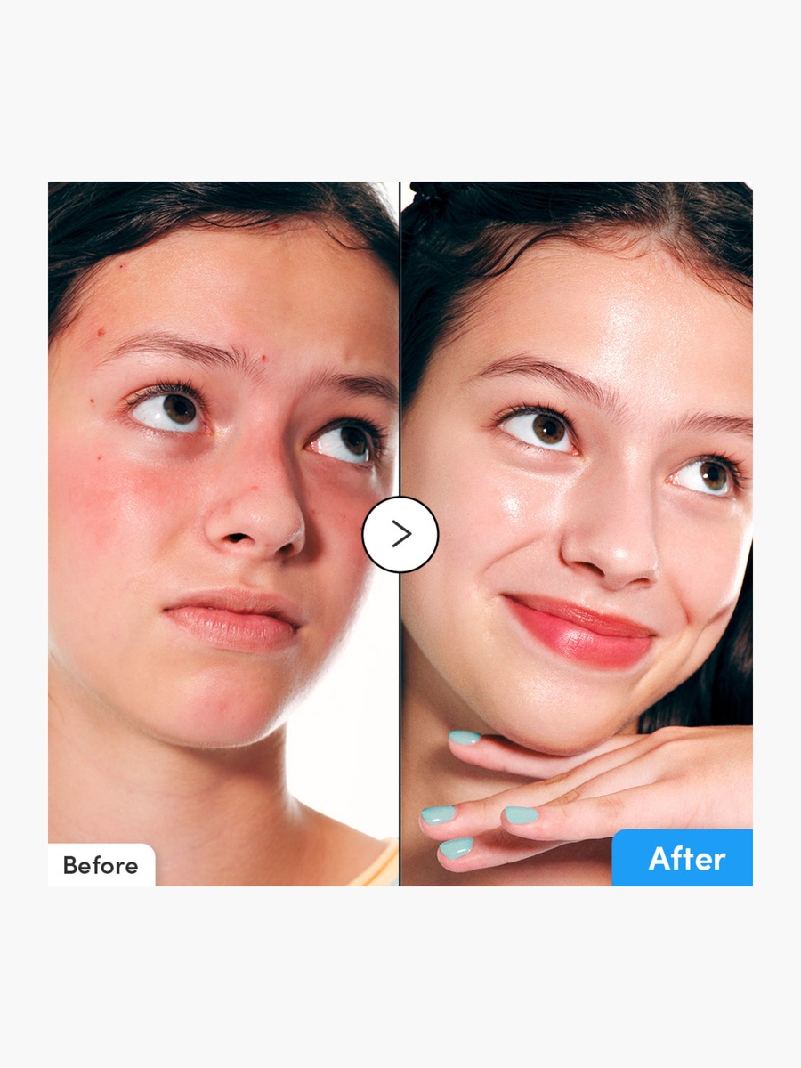 Hydrating Hyalantoin Flooding Serum 30ml
