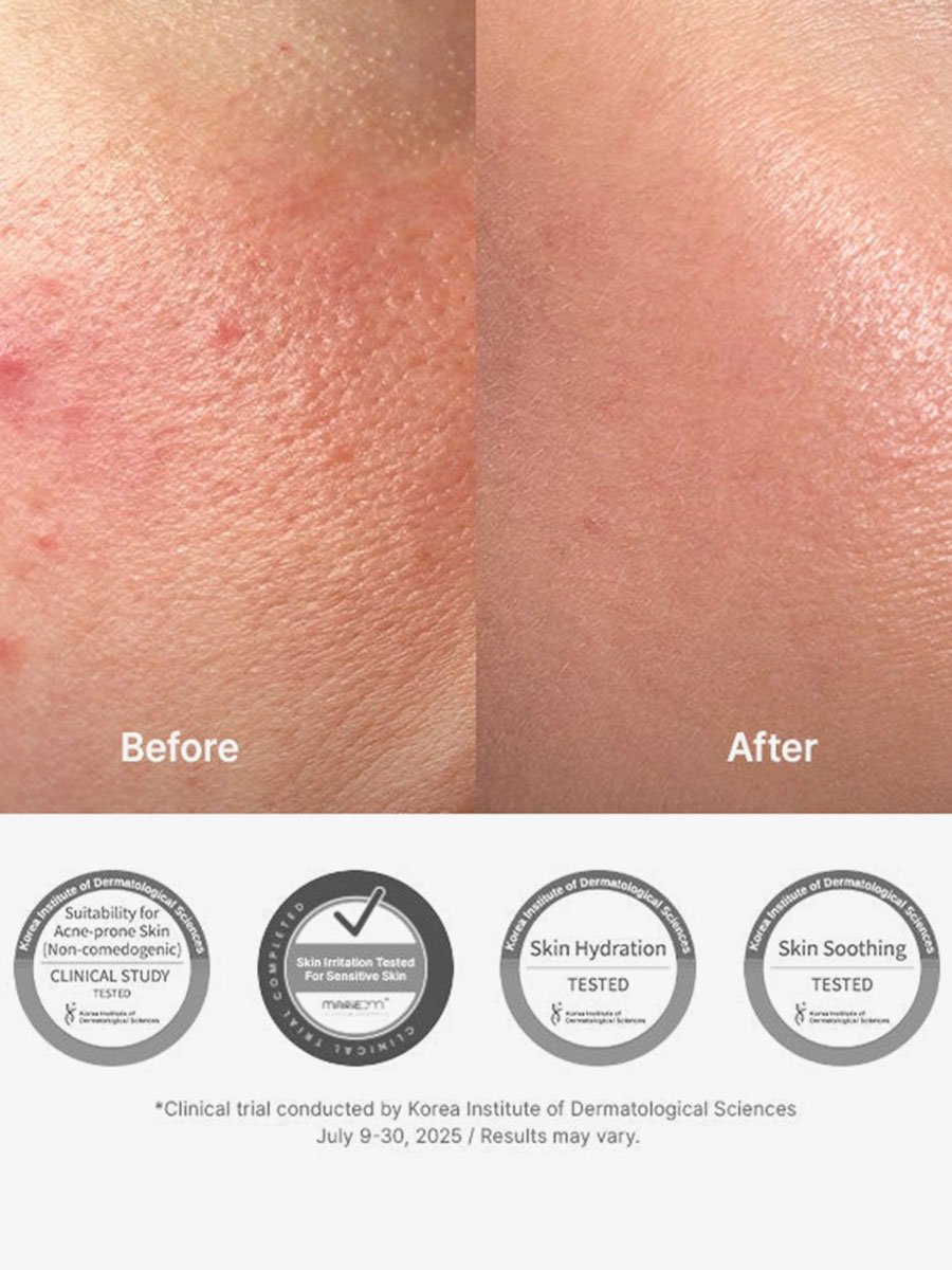 345 Relief Cream
