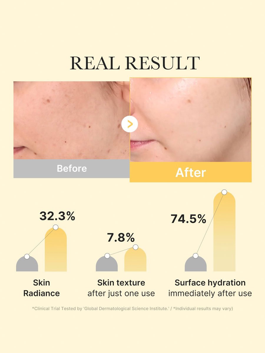 Kojic Acid Turmeric Gold Jelly Gel Mask