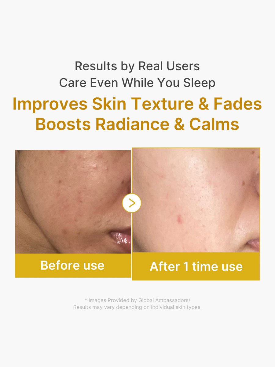 Kojic Acid Turmeric Night Wrapping Mask