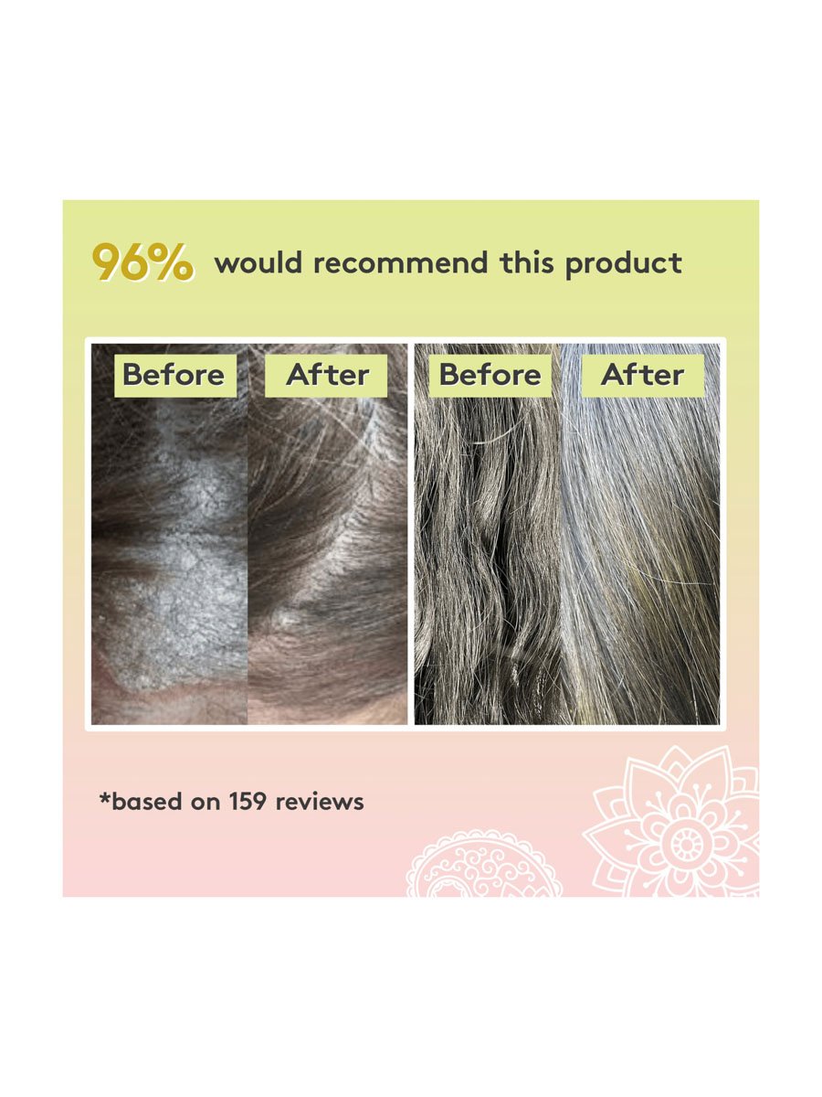 Rich Roots Hair and Scalp Oil - Amla & Rosemary 50ml
