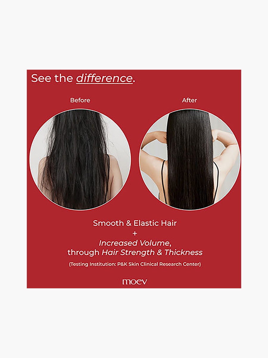 Annurcatin Shampoo 300Ml