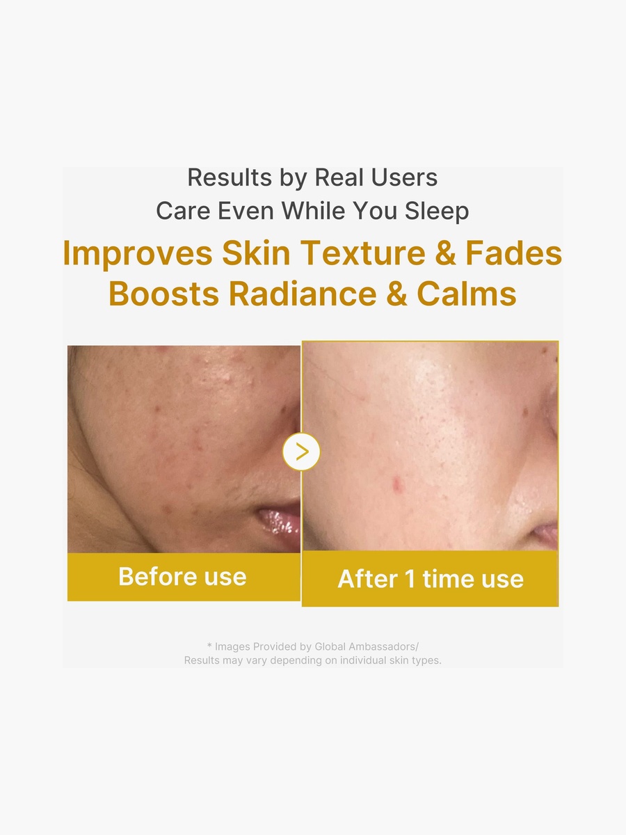 Kojic Acid Turmeric Night Wrapping Mask 75Ml