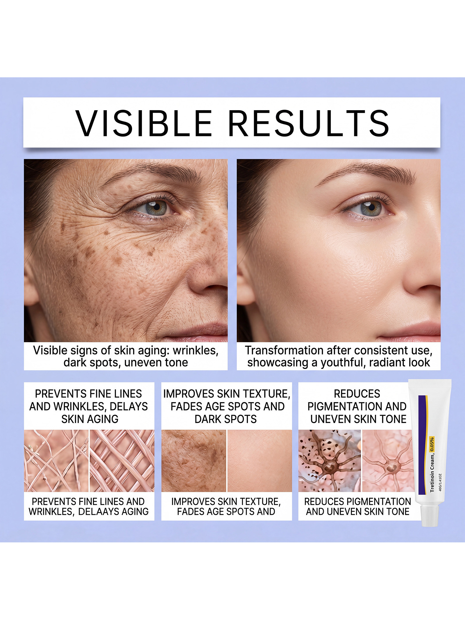 Tretinoin Cream 0.05% 40G